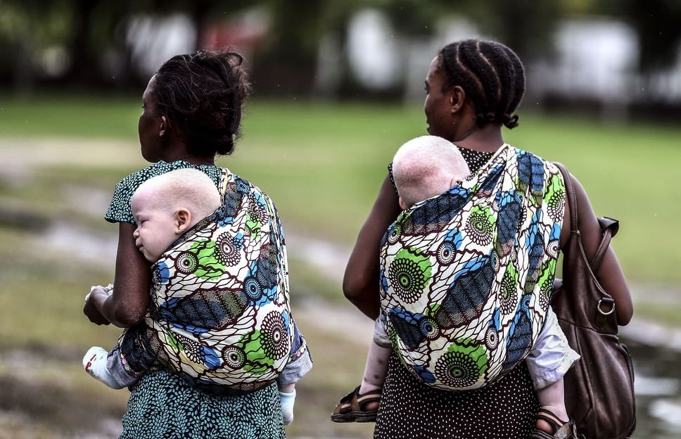 Des femmes tanzaniennes portant leurs enfants albinos.